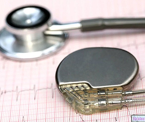 Stimulateur cardiaque : qu'est-ce que c'est ? A quoi ça sert et Intervention