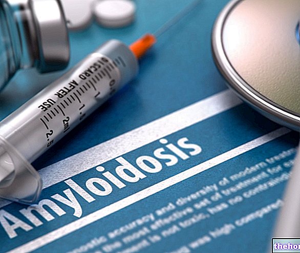 प्राथमिक अमाइलॉइडोसिस: यह क्या है? कारण, लक्षण और उपचार