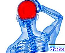 Étapes de la migraine et causes de la migraine