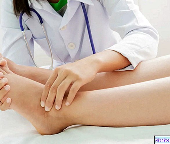 Chevilles et jambes enflées - Causes et remèdes
