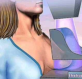 Mammograafia