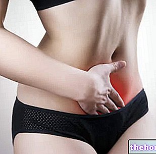Endometriose symptomer