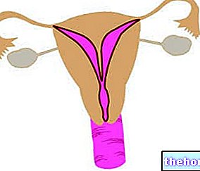 Septum de l'utérus