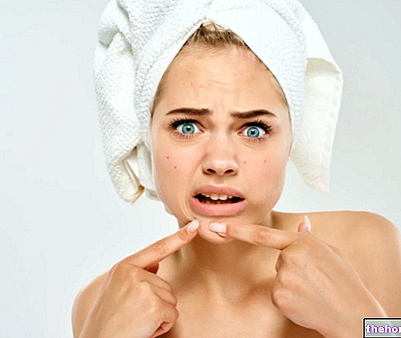 Pimples na bradě: Prostředky a léčby