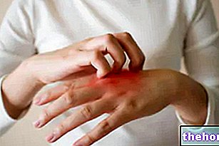 Itching: What is it? Causes, Diagnosis and Treatment