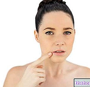 मुंह के कोनों में कटने के उपाय