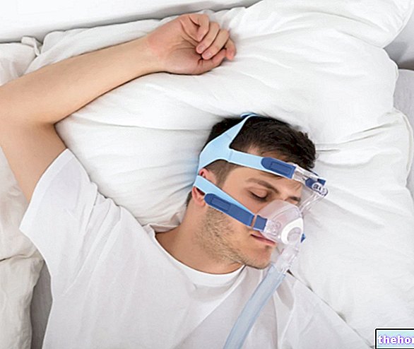 Obstruktives Schlafapnoe-Syndrom: Behandlung
