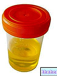 Protéine dans l'urine - Protéinurie