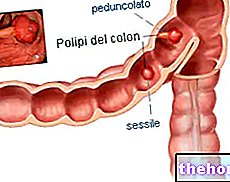 Polypes intestinaux
