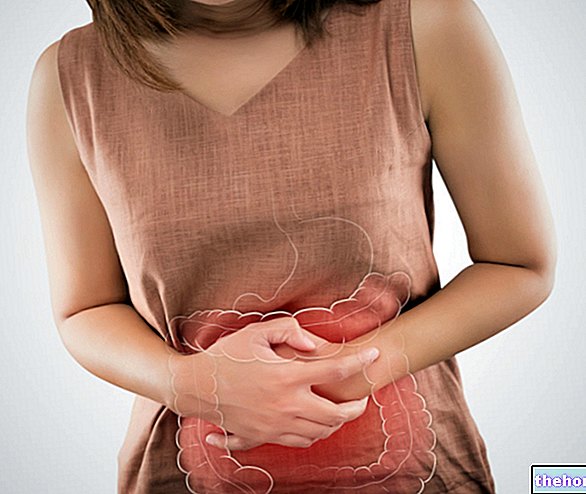 Síndrome del colon irritable: ¿qué es? Causas