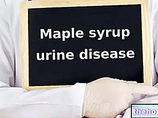 Maladie des urines au sirop d'érable