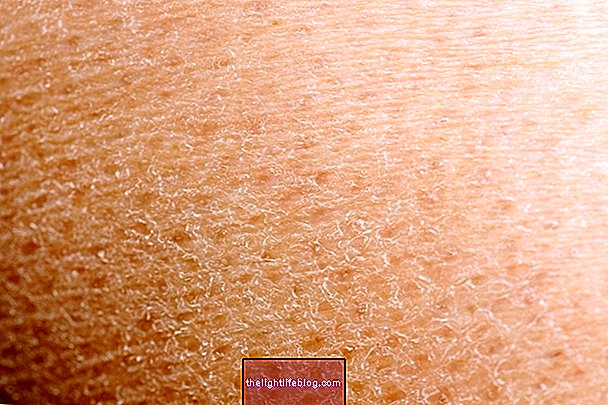 Peeling de la peau: 9 causes principales et que faire