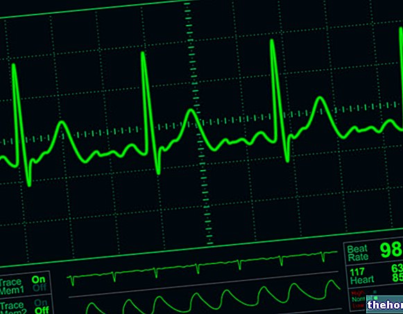 Anomalies électrocardiographiques