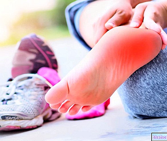 Plantar Fasciitis การแตกของ Aponeurosis และ Kinesiological Taping®