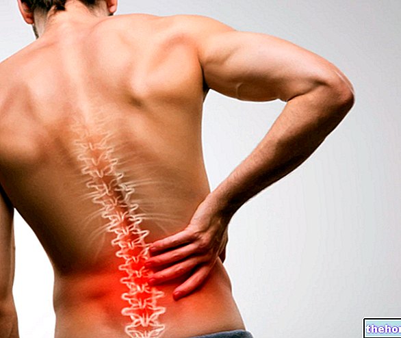 Nugaros skausmas ir laikysenos terapija