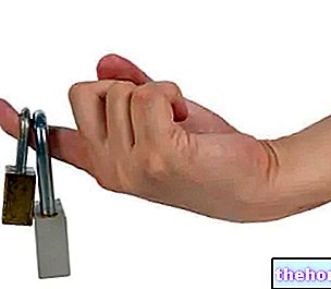 Nopea sormi (ahtauttava tenosynoviitti sormien taivuttajista)