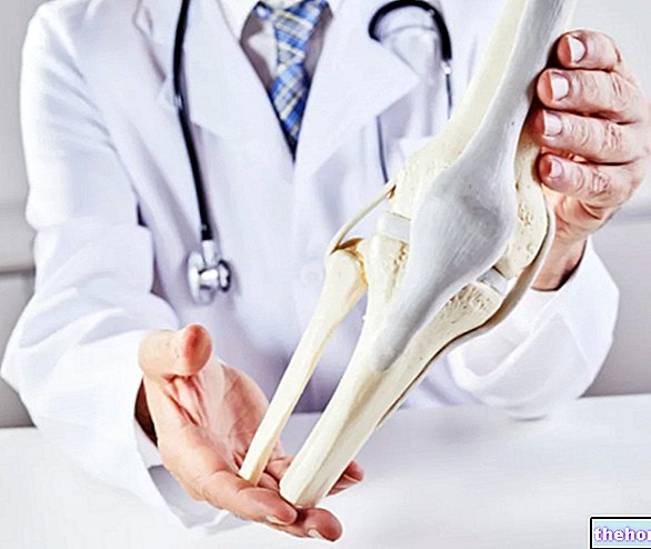 Osteosarcoma: ¿qué es y cómo se manifiesta?