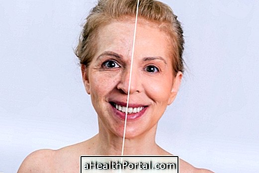 Meilleurs traitements pour combattre la flaccidité du visage et devenir plus jeune