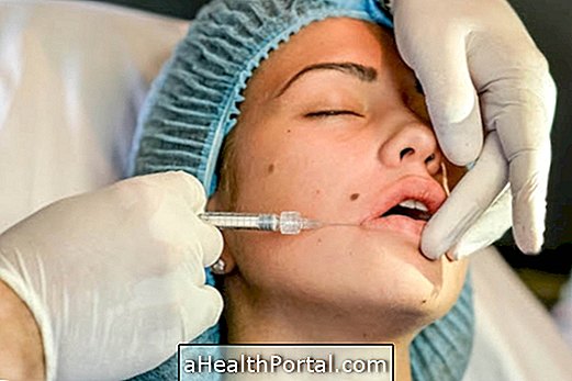 La chirurgie plastique sur la bouche peut augmenter ou diminuer les lèvres