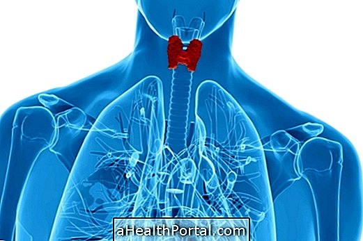 7 symptômes pouvant indiquer un cancer de la thyroïde