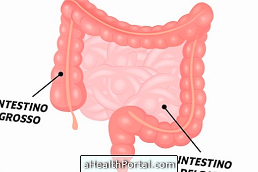 Intestin: à quoi ça sert et les principales maladies