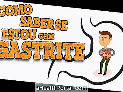 Gastrite: symptômes, types, causes et traitement