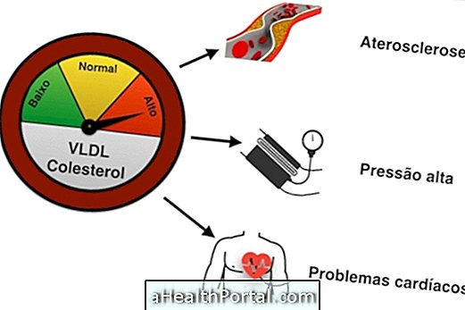 Le cholestérol élevé de VLDL peut causer l'athérosclérose