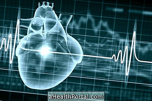 8 maladies qui causent une arythmie cardiaque