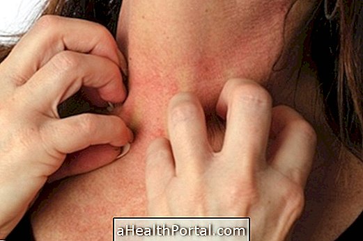 6 principales causes de démangeaisons de la peau et comment les traiter