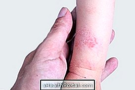 Qu'est-ce que et comment identifier la dermatite atopique?