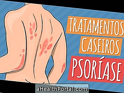 Comment traiter le psoriasis inversé