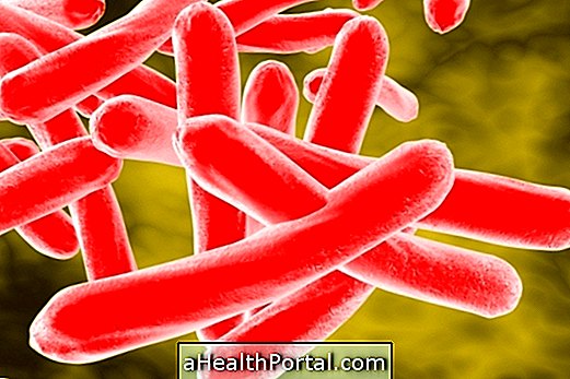Qu'est-ce que la tuberculose ganglionnaire, symptômes, contagion et traitement?