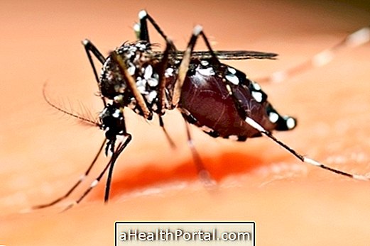Apprenez à traiter la dengue pour prévenir les complications