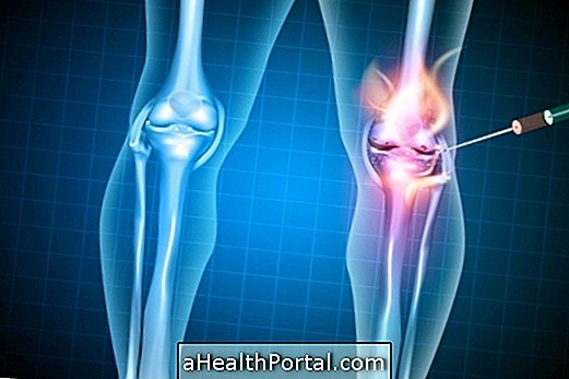 L'infiltration du genou combat la douleur et améliore l'arthrite