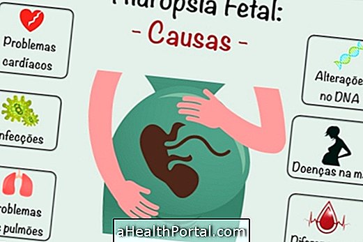 Quelles sont les causes Hydrops foetaux et complications possibles