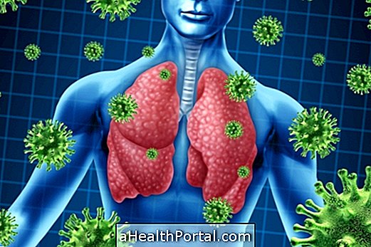 Principaux symptômes et causes de pneumonie virale