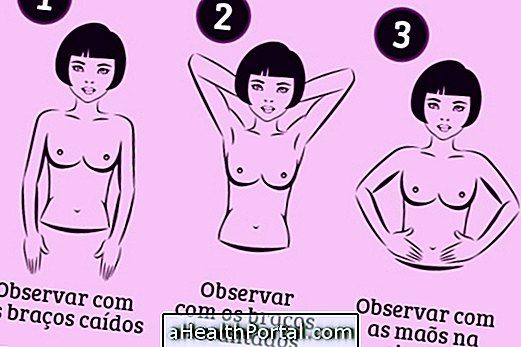 Comment faire l'auto-examen des seins