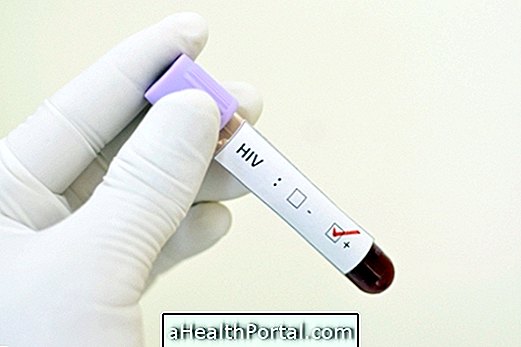 Comprendre le résultat du test VIH