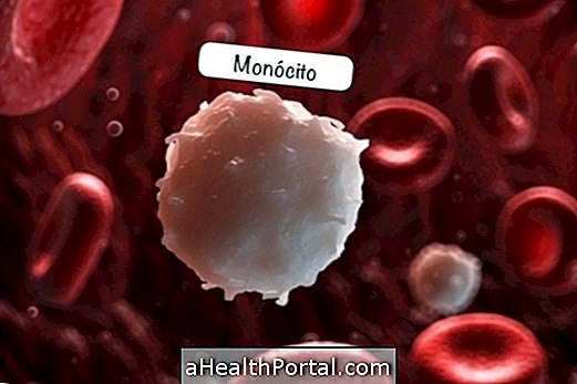 Les monocytes - Ce qu'ils sont et les valeurs de référence