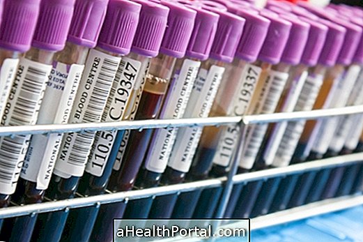 Voir les tests sanguins qui détectent le cancer