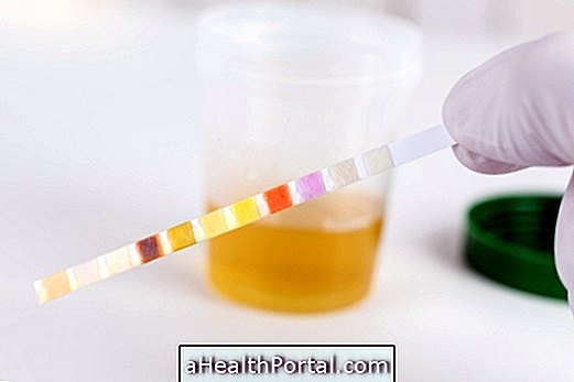 Que signifie protéines dans l'urine pendant la grossesse?