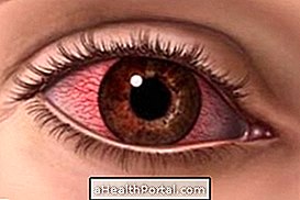 Comment enlever la tache de sang dans l'oeil