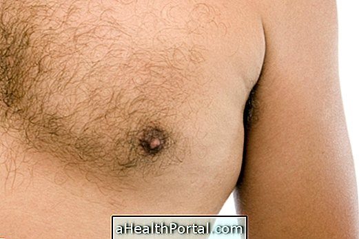 Symptômes et traitement du cancer du sein chez les hommes