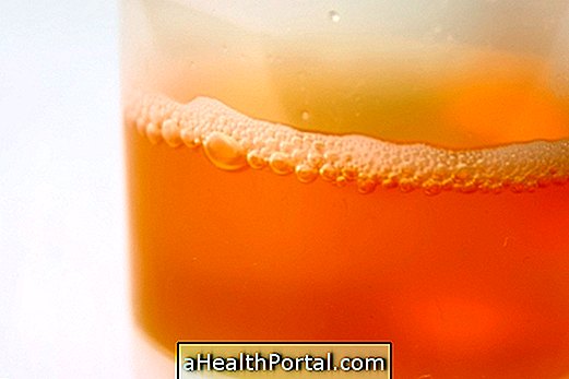 Découvrez quelles sont les principales causes de l'urine avec de la mousse