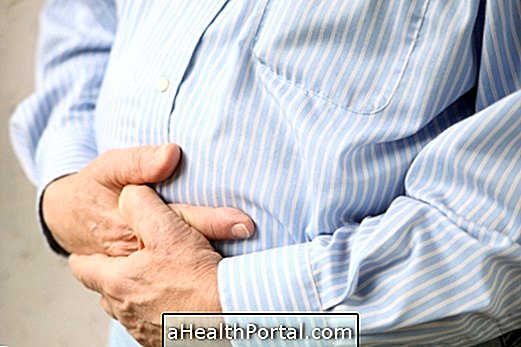 Top 10 des causes de douleur abdominale