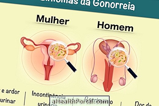 Symptômes de la gonorrhée