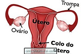 Symptômes et causes des plaies dans l'utérus