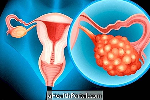 Symptômes de l'inflammation dans l'ovaire