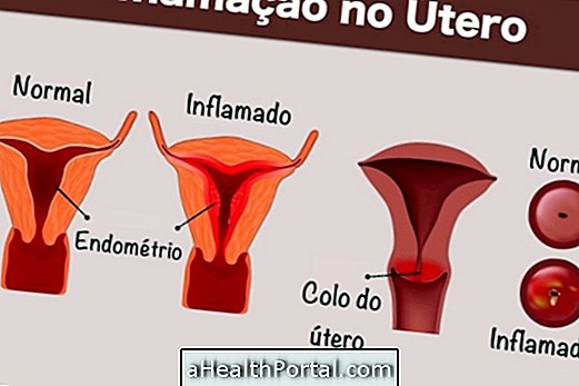 Comment identifier et traiter l'inflammation dans l'utérus